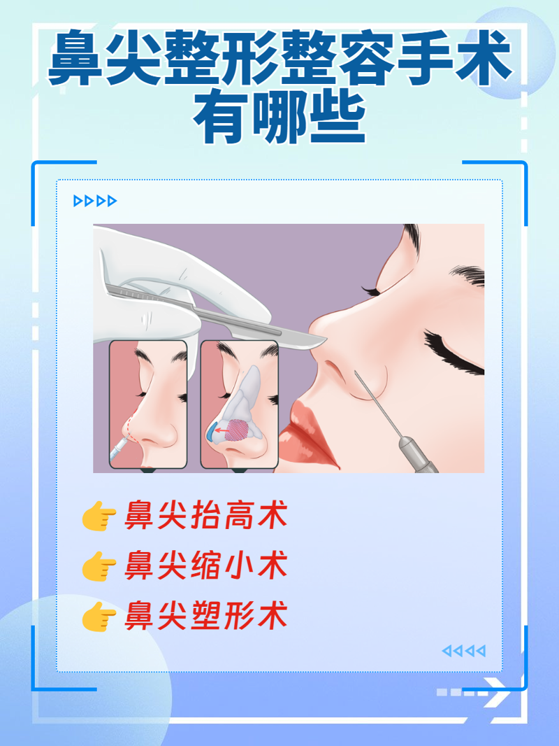 面部整形：打开美丽新天地的新钥匙